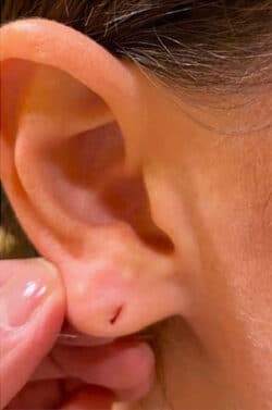 Earlobes